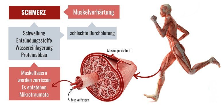 Was Hilft Gegen Muskelkater Schnelle Und Sichere Tipps